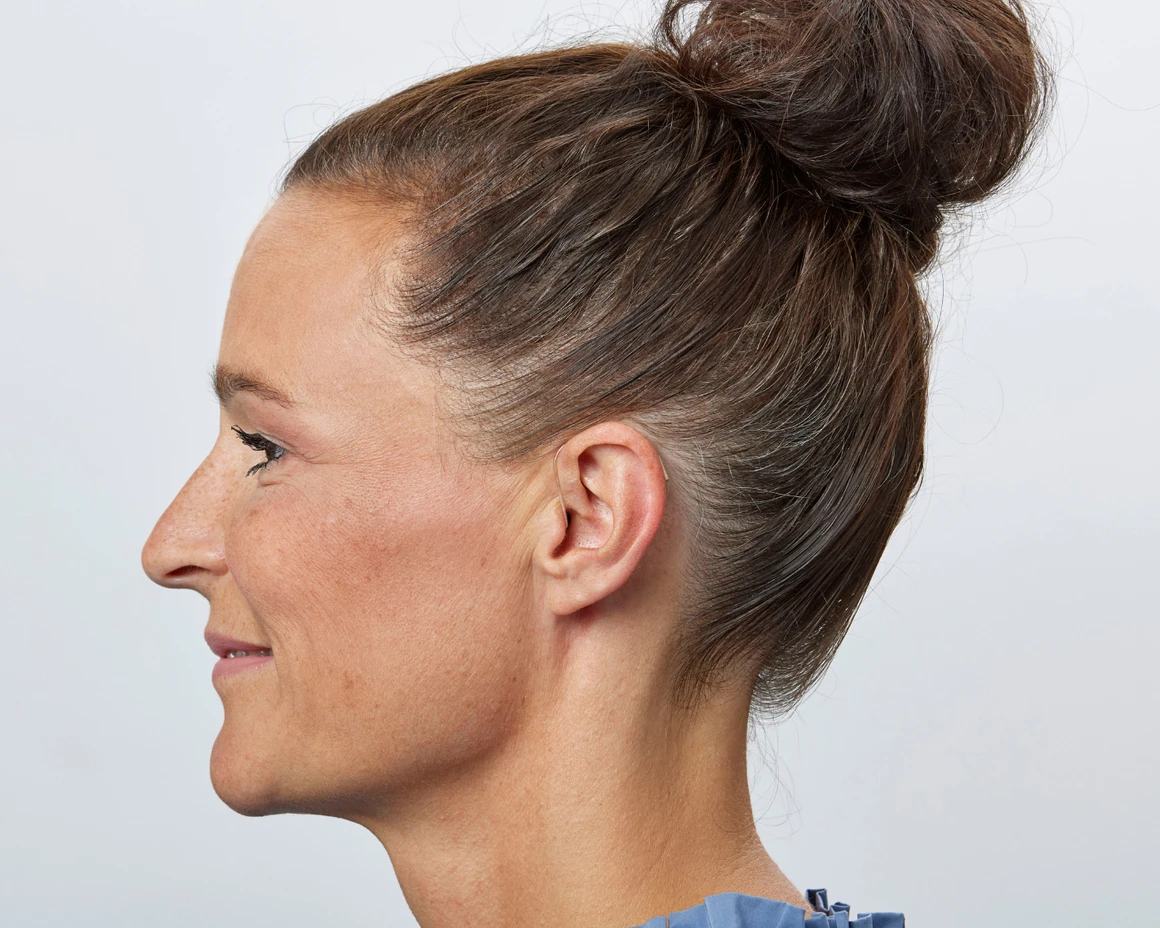 A woman wearing an Oticon Intent hearing aid in her ear, side view.